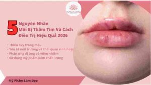 5 Nguyên Nhân Môi Bị Thâm Tím Và Cách Điều Trị